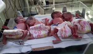 कोरबा के कृष्णा हॉस्पिटल में एक महिला ने दिया 4 बच्चे को जन्म...जच्चा-बच्चा दोनों स्वस्थ... परिजनों में खुशी की लहर