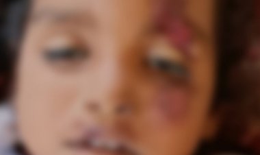 मां के हाथ से छूटी बच्ची ऑटो से गिरी, मौत:परिवार के साथ जा रही थी, सिवनी में मेहता गांव के पास हादसा