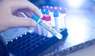 छत्तीसगढ़ में कोरोना को लेकर राहतभरी खबर; तीन दिन में ठीक हुआ पहला संक्रमित, लक्षण गंभीर नहीं, मगर सावधानी जरूरी