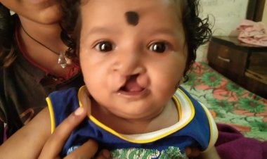 चिरायु योजना से लौट रही बच्चों की मुस्कान