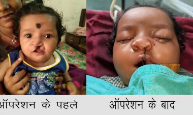 गंभीर बीमारियों से पीड़ित बच्चों को मिल रहा नया जीवन