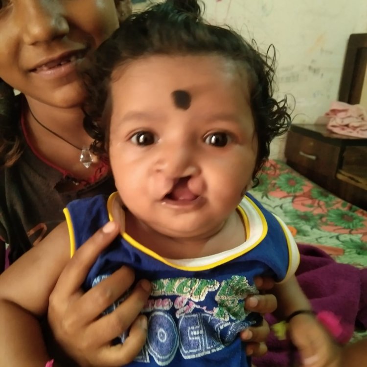 चिरायु योजना से लौट रही बच्चों की मुस्कान