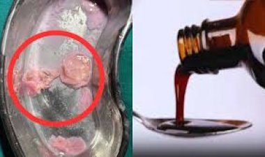 सीरप की बोतल में संदिग्ध वस्तु मिलने का मामला, जांच के लिए नमूने भेजे गए राज्य औषधि परीक्षण प्रयोगशाला