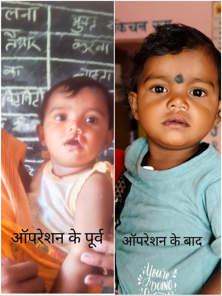 शासन की योजना से दूर हुई बेटी के भविष्य की चिंता, चिरायु दल ने लौटाई मासूम रंजना की मुस्कान