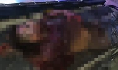 दिल दहला देने वाला हादसा, ट्रेन की चपेट में आए युवक का हाथ कटकर शरीर से हुआ अलग, दर्दनाक मंजर देख मची अफरा-तफरी