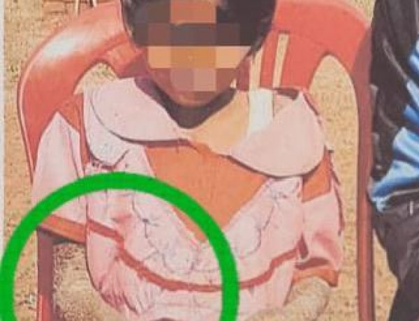डॉ. वर्णिका शर्मा के निर्देश पर बच्ची के बेहतर उपचार की दिशा में बड़ा कदम